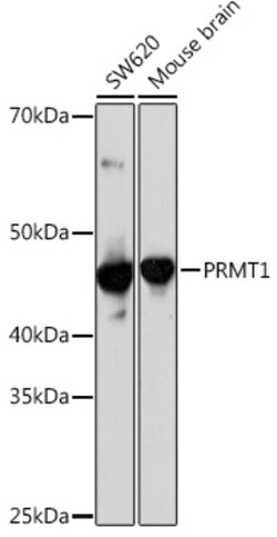 Invitrogen PRMT1 Recombinant Rabbit Monoclonal Antibody (10W10U4) 100 &mu;L:Antibodies,