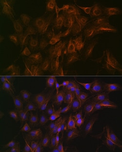Invitrogen Arp3 Recombinant Rabbit Monoclonal Antibody (8K4F2) 100 &mu;L:Antibodies,