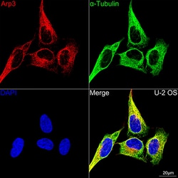 Invitrogen Arp3 Recombinant Rabbit Monoclonal Antibody (8K4F2) 100 &mu;L:Antibodies,