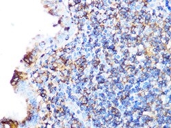Invitrogen Arp3 Recombinant Rabbit Monoclonal Antibody (8K4F2) 100 &mu;L:Antibodies,