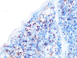 Invitrogen Arp3 Recombinant Rabbit Monoclonal Antibody (8K4F2) 100 &mu;L:Antibodies,