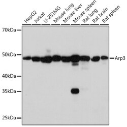 Invitrogen Arp3 Recombinant Rabbit Monoclonal Antibody (8K4F2) 100 &mu;L:Antibodies,