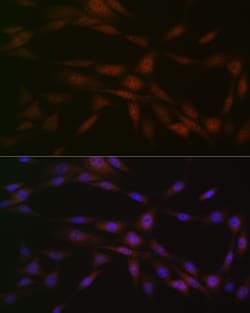 Invitrogen CK2 beta Recombinant Rabbit Monoclonal Antibody (9T5J10) 100
