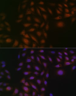 Invitrogen CK2 beta Recombinant Rabbit Monoclonal Antibody (9T5J10) 100
