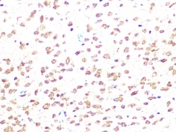 Invitrogen CK2 beta Recombinant Rabbit Monoclonal Antibody (9T5J10) 100