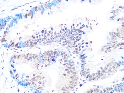 Invitrogen CK2 beta Recombinant Rabbit Monoclonal Antibody (9T5J10) 100