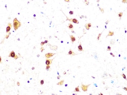 Invitrogen CK2 beta Recombinant Rabbit Monoclonal Antibody (9T5J10) 100