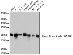 Invitrogen CK2 beta Recombinant Rabbit Monoclonal Antibody (9T5J10) 100