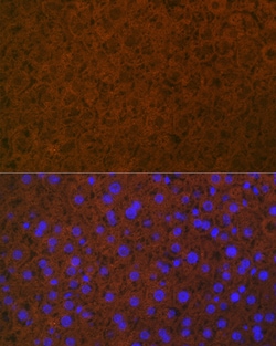 Invitrogen Protein C Recombinant Rabbit Monoclonal Antibody (3W3R7) 100 &mu;L | Buy Online | Invitrogen&trade; | Fisher Scientific