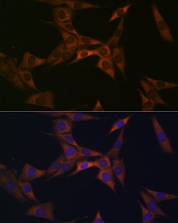 Invitrogen BMP6 Recombinant Rabbit Monoclonal Antibody (6N5S9) 100 &mu;L;