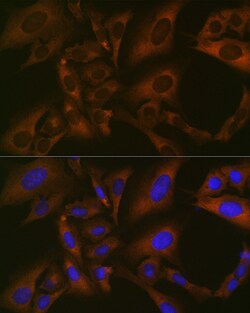 Invitrogen BMP6 Recombinant Rabbit Monoclonal Antibody (6N5S9) 100 &mu;L;
