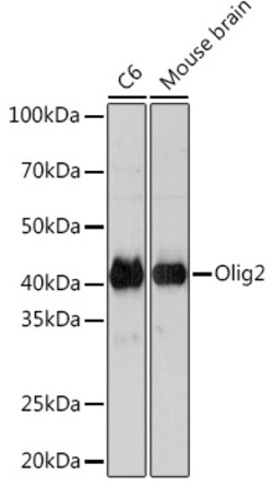 Invitrogen OLIG2 Recombinant Rabbit Monoclonal Antibody (1P8G4) 100 &mu;L:Antibodies,