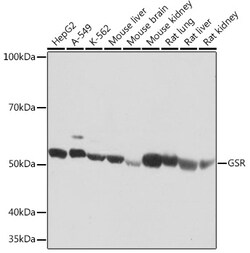 Invitrogen GSR Recombinant Rabbit Monoclonal Antibody (2J5N9) 100 &mu;L:Antibodies,