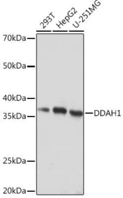 Invitrogen DDAH1 Recombinant Rabbit Monoclonal Antibody (1Q5F6) 100 &mu;L;