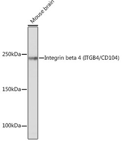 Invitrogen CD104 Recombinant Rabbit Monoclonal Antibody (5Z9P3) 100 &mu;L:Antibodies,