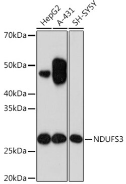 Invitrogen NDUFS3 Recombinant Rabbit Monoclonal Antibody (2R6F5) 100 &mu;L;