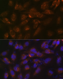 Invitrogen IGFBP7 Recombinant Rabbit Monoclonal Antibody (8M10Q9) 100 &mu;L | Buy Online | Invitrogen&trade; | Fisher Scientific