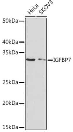 Invitrogen IGFBP7 Recombinant Rabbit Monoclonal Antibody (8M10Q9) 100 &mu;L | Buy Online | Invitrogen&trade; | Fisher Scientific