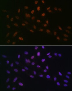 Invitrogen MTA2 Recombinant Rabbit Monoclonal Antibody (9A5Y7) 100 &mu;L:Antibodies,
