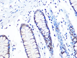 Invitrogen MTA2 Recombinant Rabbit Monoclonal Antibody (9A5Y7) 100 &mu;L:Antibodies,