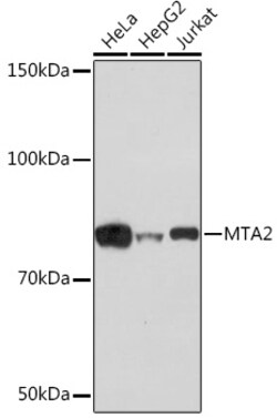 Invitrogen MTA2 Recombinant Rabbit Monoclonal Antibody (9A5Y7) 100 &mu;L:Antibodies,