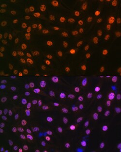 Invitrogen MAD2L2 Recombinant Rabbit Monoclonal Antibody (7B6I2) 100 &mu;L:Antibodies,