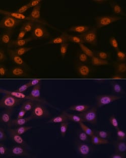 Invitrogen MAD2L2 Recombinant Rabbit Monoclonal Antibody (7B6I2) 100 &mu;L:Antibodies,