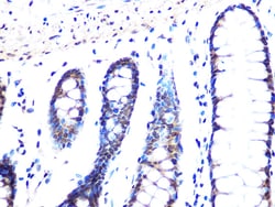 Invitrogen MAD2L2 Recombinant Rabbit Monoclonal Antibody (7B6I2) 100 &mu;L:Antibodies,