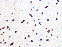 Invitrogen TPPP Recombinant Rabbit Monoclonal Antibody (3S5U9) 100 &mu;L;