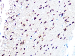 Invitrogen TPPP Recombinant Rabbit Monoclonal Antibody (3S5U9) 100 &mu;L;