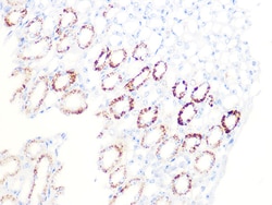 Invitrogen PDHB Recombinant Rabbit Monoclonal Antibody (7V8O5) 100 &mu;L:Antibodies,