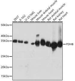 Invitrogen PDHB Recombinant Rabbit Monoclonal Antibody (7V8O5) 100 &mu;L:Antibodies,