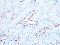 Invitrogen IRAK2 Recombinant Rabbit Monoclonal Antibody (10G3F8) 100 &mu;L | Buy Online | Invitrogen&trade; | Fisher Scientific