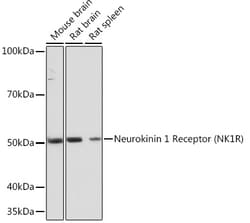 Invitrogen TACR1 Recombinant Rabbit Monoclonal Antibody (9T1W2) 100 &mu;L:Antibodies,