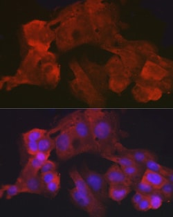 Invitrogen Villin Recombinant Rabbit Monoclonal Antibody (5Q2V9) 100 &mu;L;