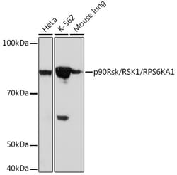 Invitrogen RSK1 Recombinant Rabbit Monoclonal Antibody (9D9U7) 100 &mu;L | Buy Online | Invitrogen&trade; | Fisher Scientific