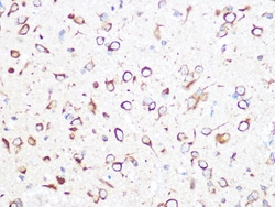 Invitrogen TCP-1 beta Recombinant Rabbit Monoclonal Antibody (9N6B4) 100