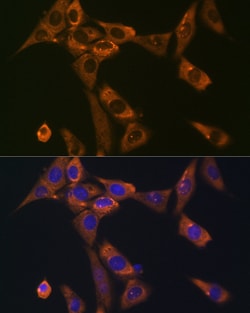 Invitrogen Galectin 1 Recombinant Rabbit Monoclonal Antibody (7W5Q6) 100