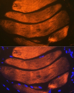 Invitrogen TNNI2 Recombinant Rabbit Monoclonal Antibody (2H7S10) 100 &mu;L:Antibodies,
