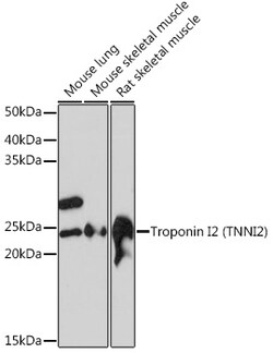 Invitrogen TNNI2 Recombinant Rabbit Monoclonal Antibody (2H7S10) 100 &mu;L:Antibodies,