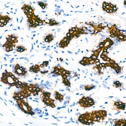 Invitrogen Cytokeratin 7 Recombinant Rabbit Monoclonal Antibody (6Q1B4) 100 &mu;L | Buy Online | Invitrogen&trade; | Fisher Scientific