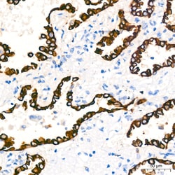 Invitrogen Cytokeratin 7 Recombinant Rabbit Monoclonal Antibody (6Q1B4) 100 &mu;L | Buy Online | Invitrogen&trade; | Fisher Scientific