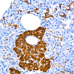 Invitrogen Cytokeratin 7 Recombinant Rabbit Monoclonal Antibody (6Q1B4) 100 &mu;L | Buy Online | Invitrogen&trade; | Fisher Scientific