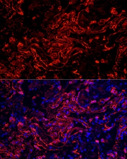 Invitrogen Cytokeratin 7 Recombinant Rabbit Monoclonal Antibody (6Q1B4) 100 &mu;L | Buy Online | Invitrogen&trade; | Fisher Scientific