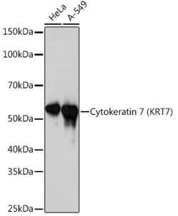Invitrogen Cytokeratin 7 Recombinant Rabbit Monoclonal Antibody (6Q1B4) 100 &mu;L | Buy Online | Invitrogen&trade; | Fisher Scientific