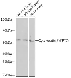 Invitrogen Cytokeratin 7 Recombinant Rabbit Monoclonal Antibody (6Q1B4) 100 &mu;L | Buy Online | Invitrogen&trade; | Fisher Scientific