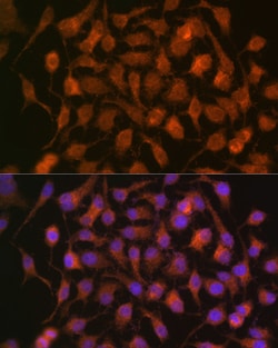 Invitrogen HSP70 Recombinant Rabbit Monoclonal Antibody (5U9A0) 100 &mu;L;