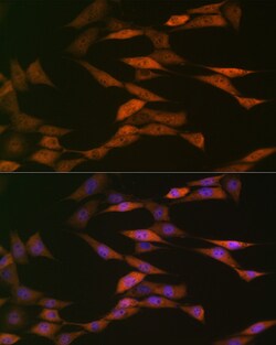 Invitrogen HSP70 Recombinant Rabbit Monoclonal Antibody (5U9A0) 100 &mu;L;
