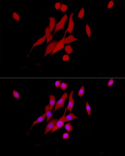 Invitrogen ERK1/2 Recombinant Rabbit Monoclonal Antibody (2Z8O1) 100 &mu;L | Buy Online | Invitrogen&trade; | Fisher Scientific