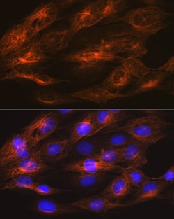 Invitrogen beta Tubulin 2 Recombinant Rabbit Monoclonal Antibody (1R3R9)
